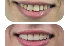 fff
